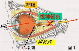 視神経図
